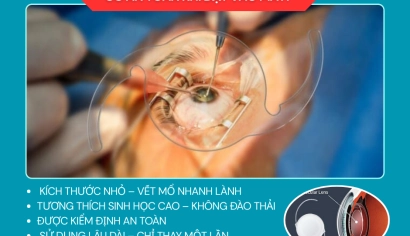 THỦY TINH THỂ NHÂN TẠO CÓ AN TOÀN KHI ĐẶT VÀO MẮT?