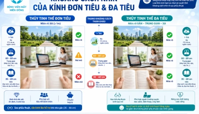 Khoảng Cách Nhìn Của Thủy Tinh Thể Nhân Tạo Đơn Tiêu Và Đa Tiêu: Nên Chọn Loại Nào Sau Mổ Đục Thủy Tinh Thể?