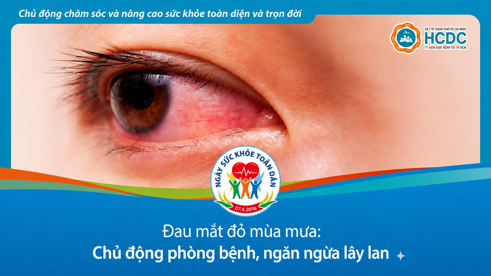 Đau mắt đỏ 
