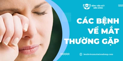 Các bệnh về mắt thường gặp và cách phòng tránh