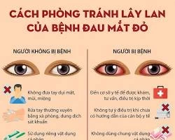 Đau mắt, đỏ mắt